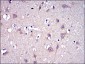 MMP9 Antibody